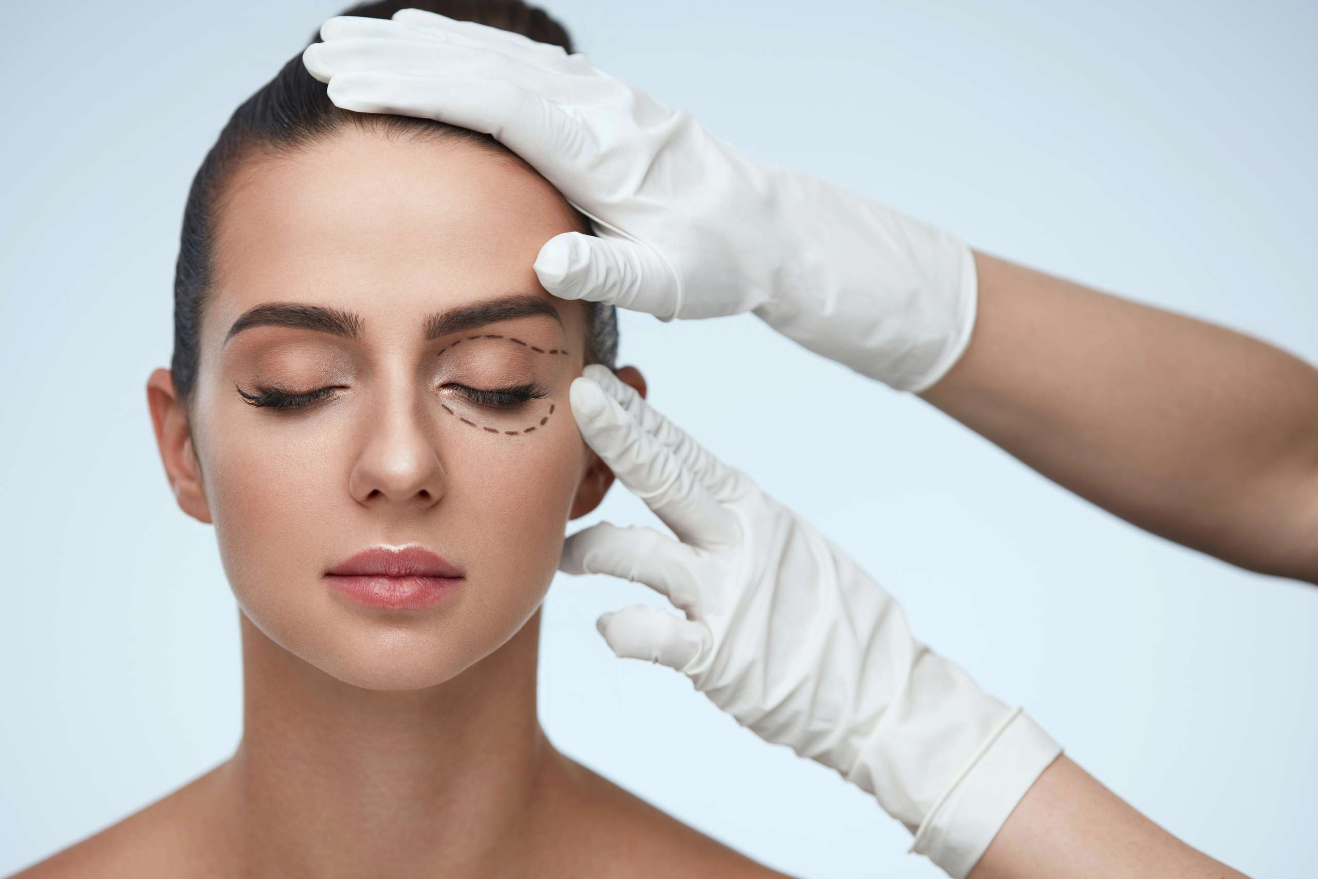blefaroplastia en Cáceres y Badajoz