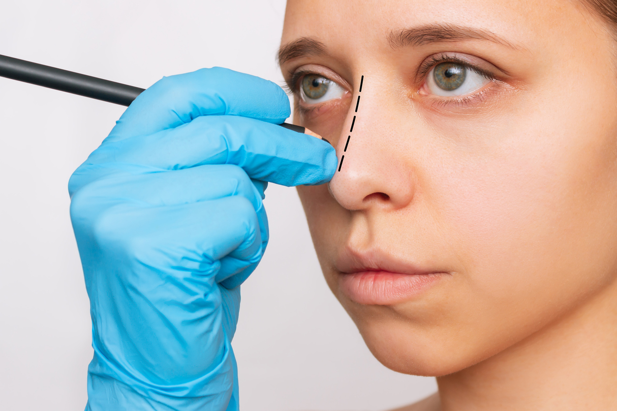 rinoplastia en Badajoz
