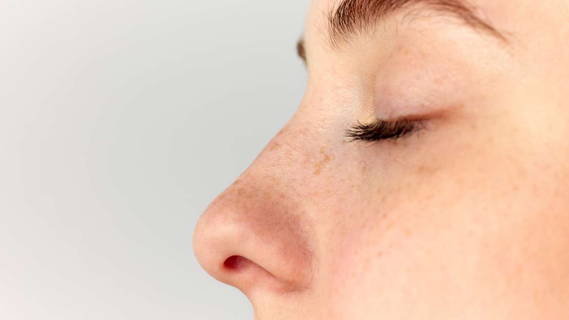 rinoplastia
