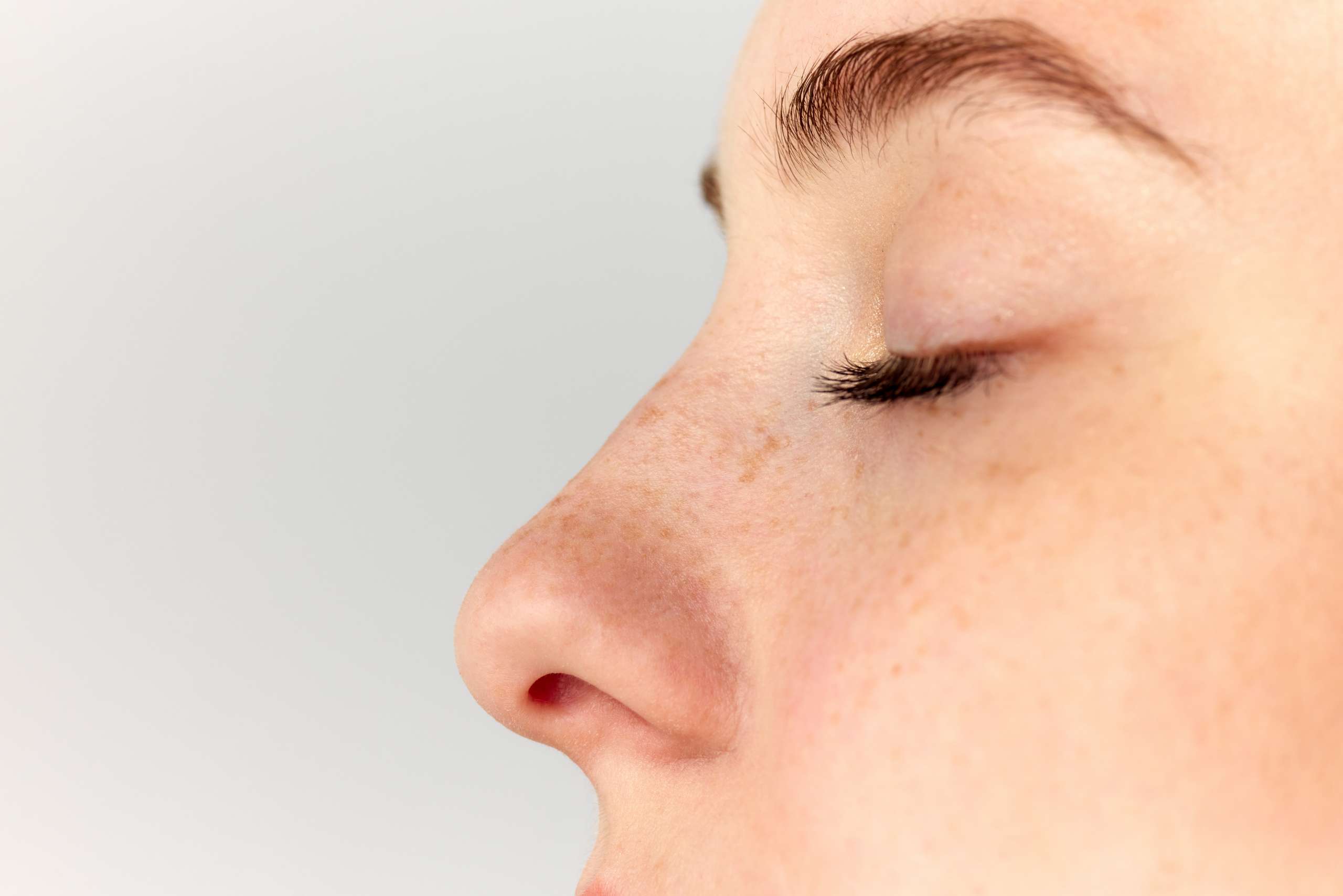 rinoplastia