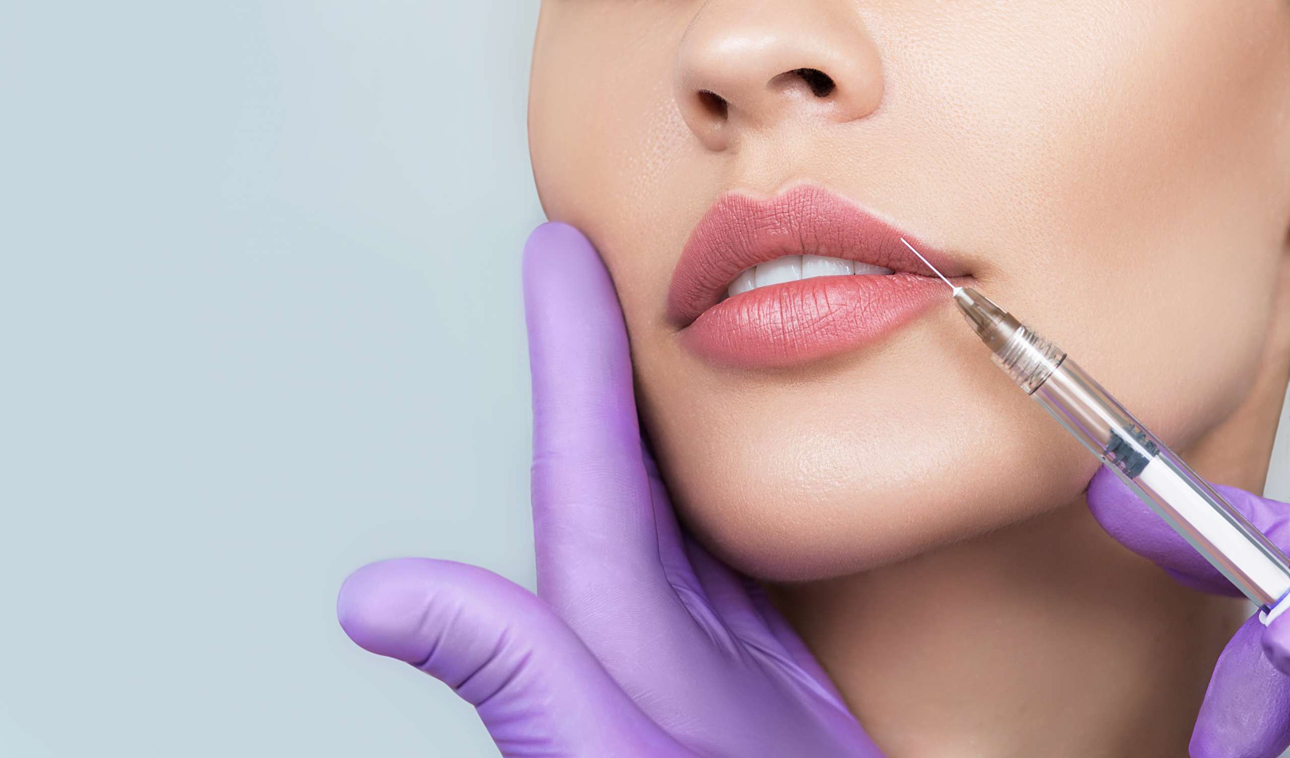 aumento de labios con ácido hialurónico
