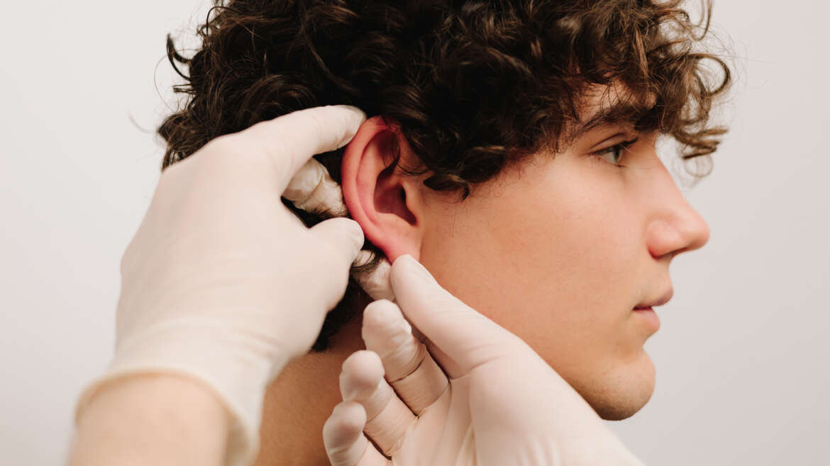 otoplastia en Extremadura