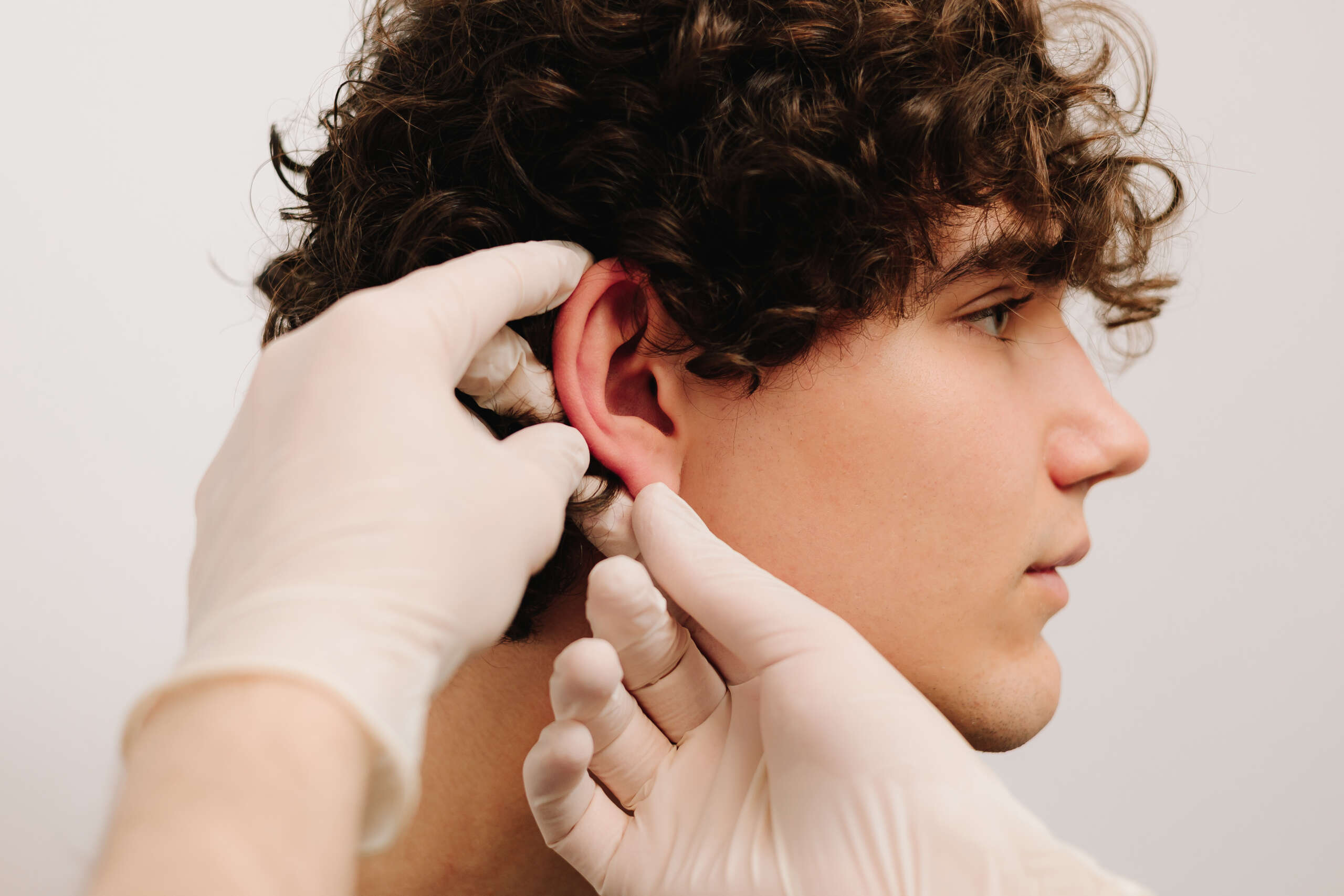 otoplastia en Extremadura