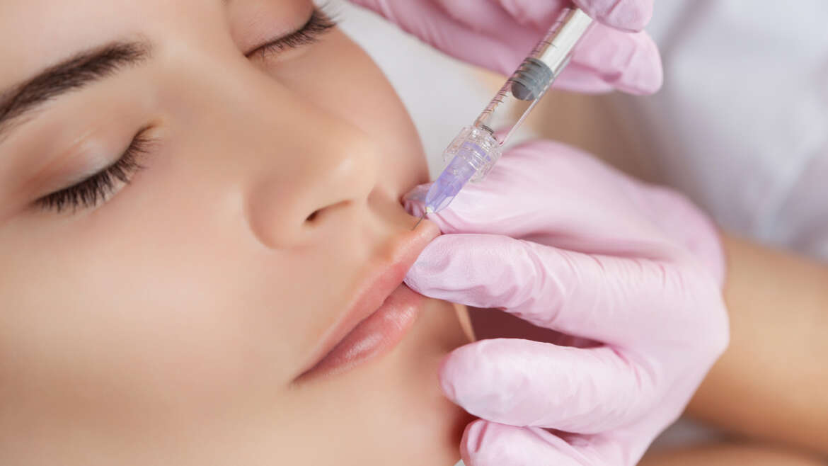 migración del ácido hialurónico