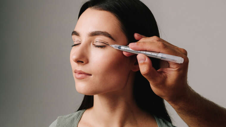 blefaroplastia en Cáceres