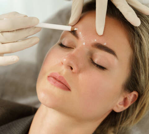 neuromoduladores en medicina estética